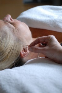 acupuncture accident route SAAQ
