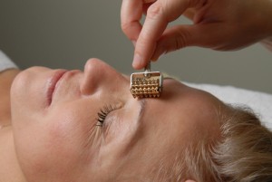 acupuncture douleur cervicale cou