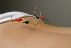 rhumatisme symptômes causes traitements physiothérapie ostéopathie acupuncture