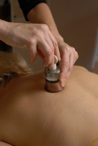 traitement douleur chronique acupuncture St_Lambert Rive-Sud