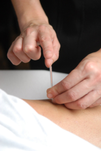 l'épicondylite (tennis elbow) traitements St-Lambert Rive-Sud